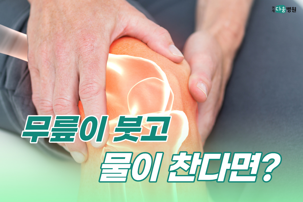 무릎이 붓고 물이찬다면?